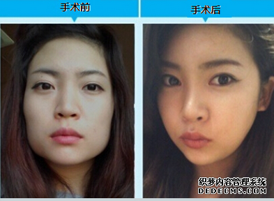 磨骨后遗症有哪些？怎么预防磨骨后遗症