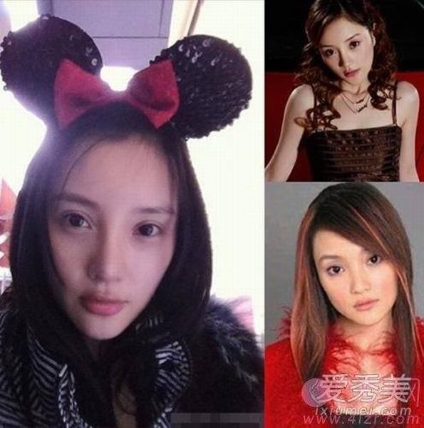 李小璐秦岚“假脸姐妹团”整形部位大揭秘
