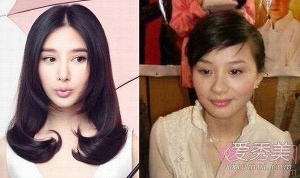 李小璐秦岚“假脸姐妹团”整形部位大揭秘