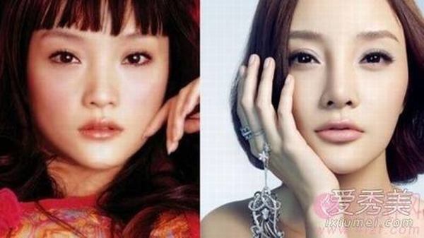 李小璐秦岚“假脸姐妹团”整形部位大揭秘