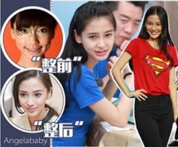明星整容前后对比照片 女神还是女妖？