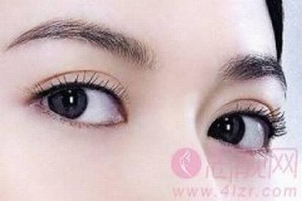 北京双眼皮修复哪家医院好？北京双眼皮修复哪里好？