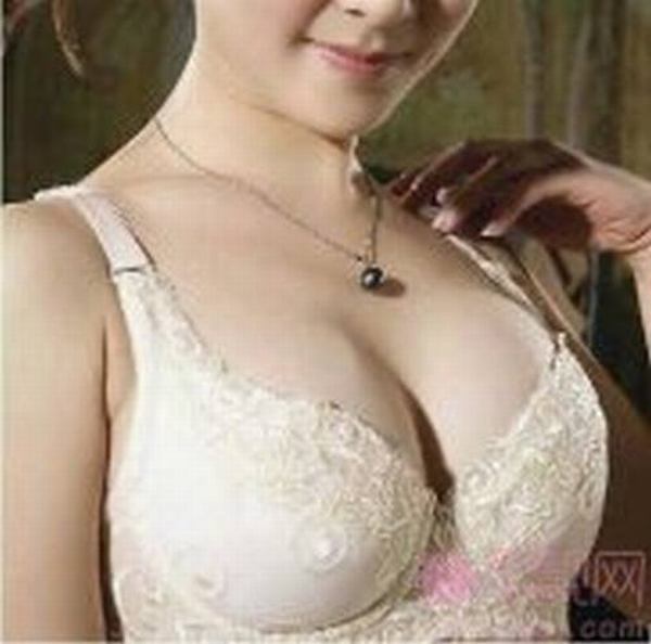 妙桃假体丰胸优势及术后注意事项
