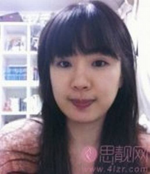 北京叶子迷你V-LINE+面部轮廓 变身清纯女