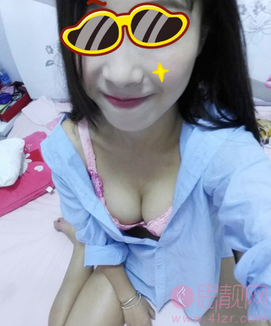 脂肪隆胸手术术后恢复照