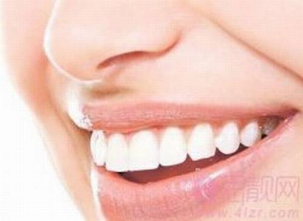 全口种植牙效果怎么样 有什么优势