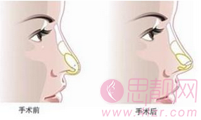 QQ截图20150807132855.png