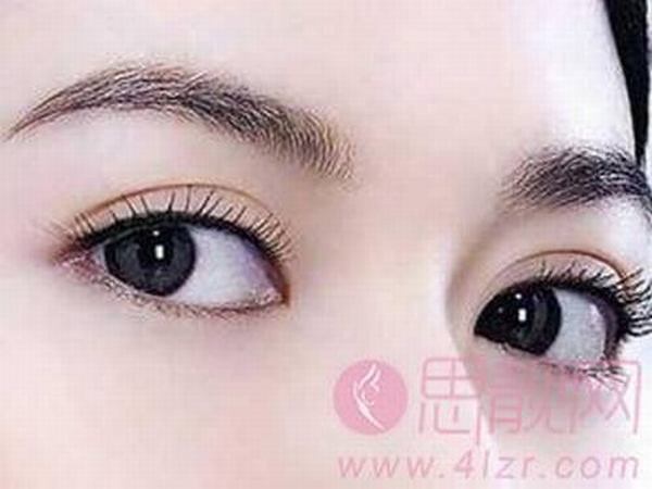 出现哪些现象说明双眼皮手术失败？