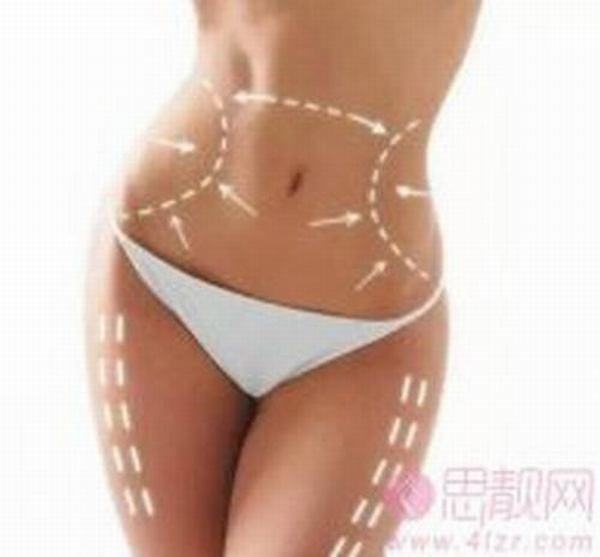 腰腹部吸脂术后饮食方面注意什么