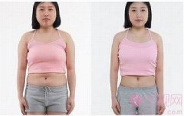 丽尚整形网：腰腹吸脂科普大全