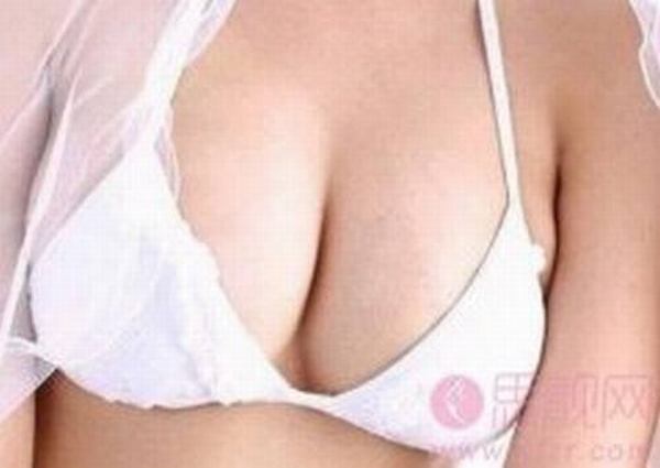 假体隆胸影响手感吗？