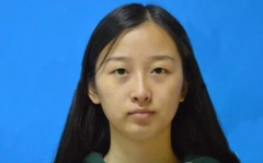 上海美莱割双眼皮小美女案例