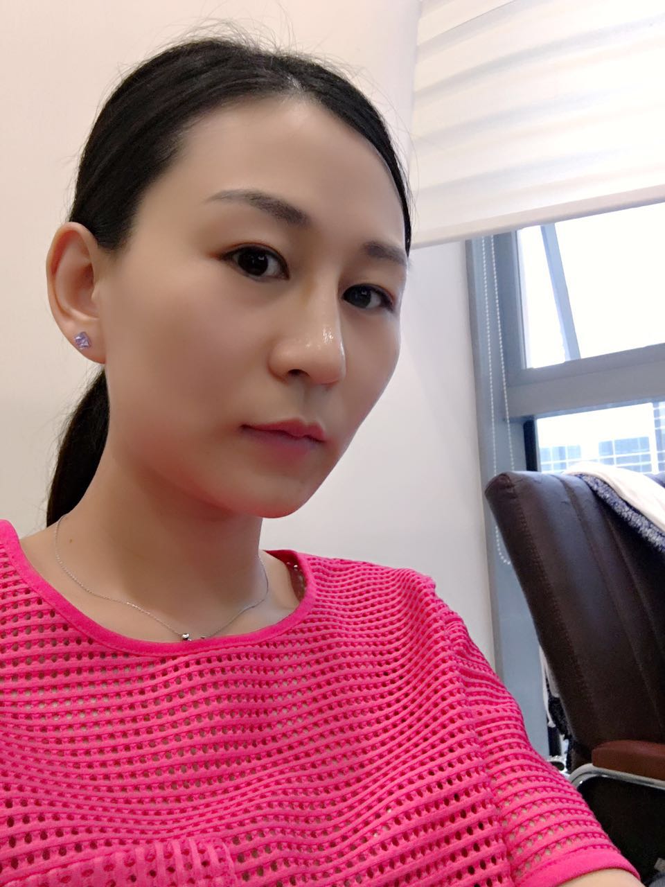 玻尿酸隆鼻维持多久？有危害吗？