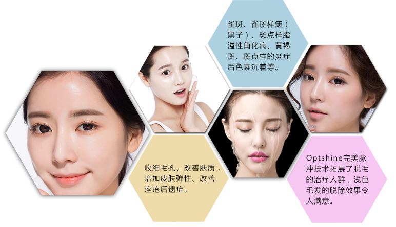 opt嫩肤有副作用吗？