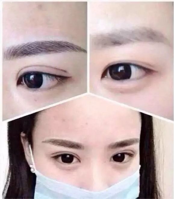 绣个眉毛一般多少钱