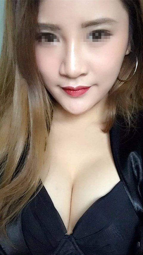 自体脂肪隆胸费用多高？