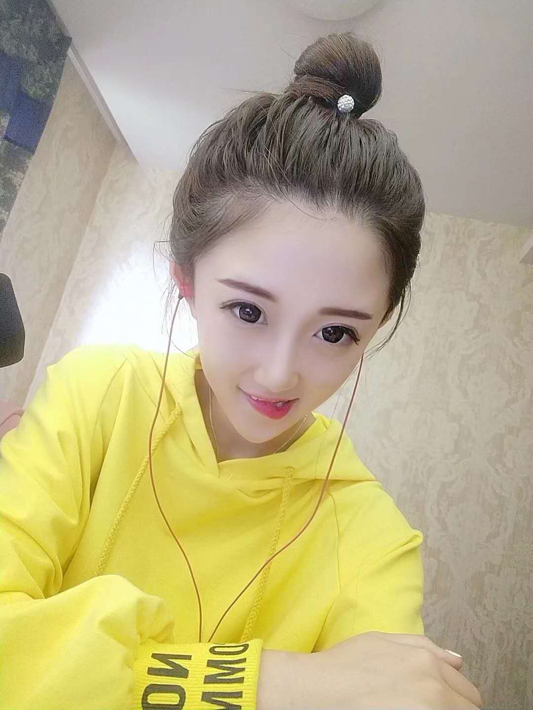 埋线双眼皮效果能维持几年？
