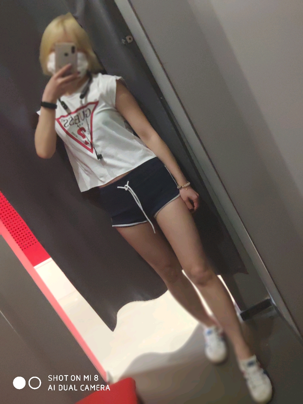 大腿吸脂后多久会瘦？