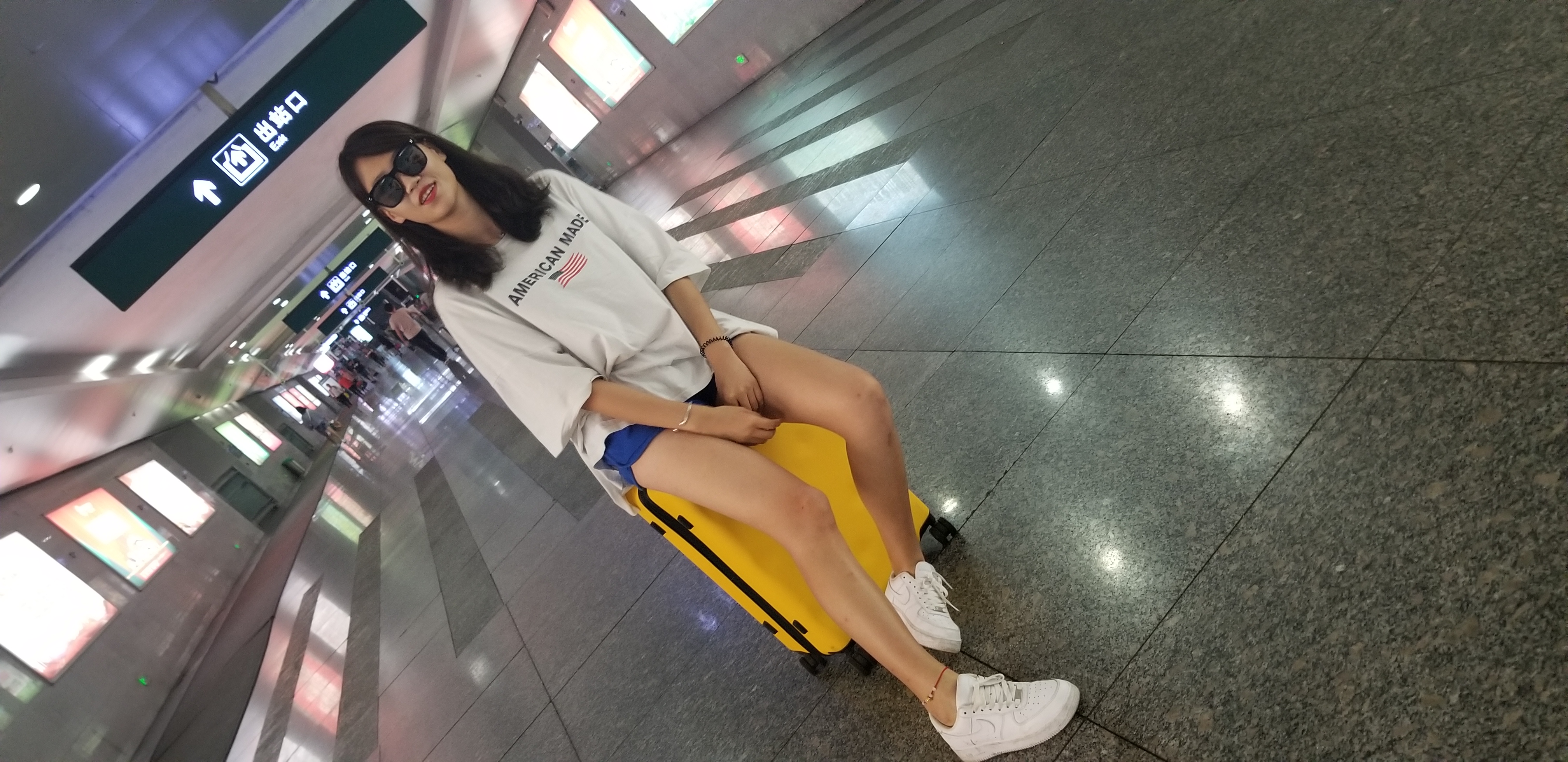 大腿吸脂修复时间?