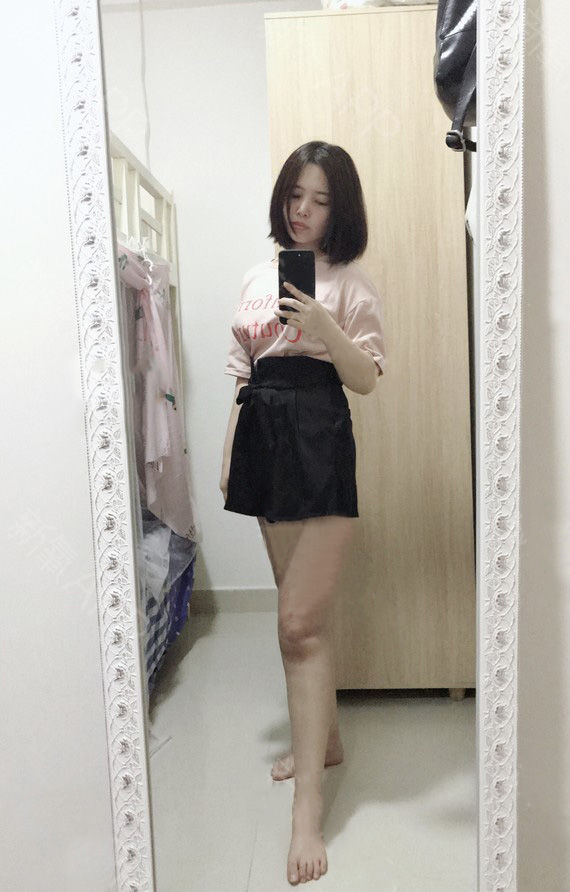 大腿吸脂多久可以见效?