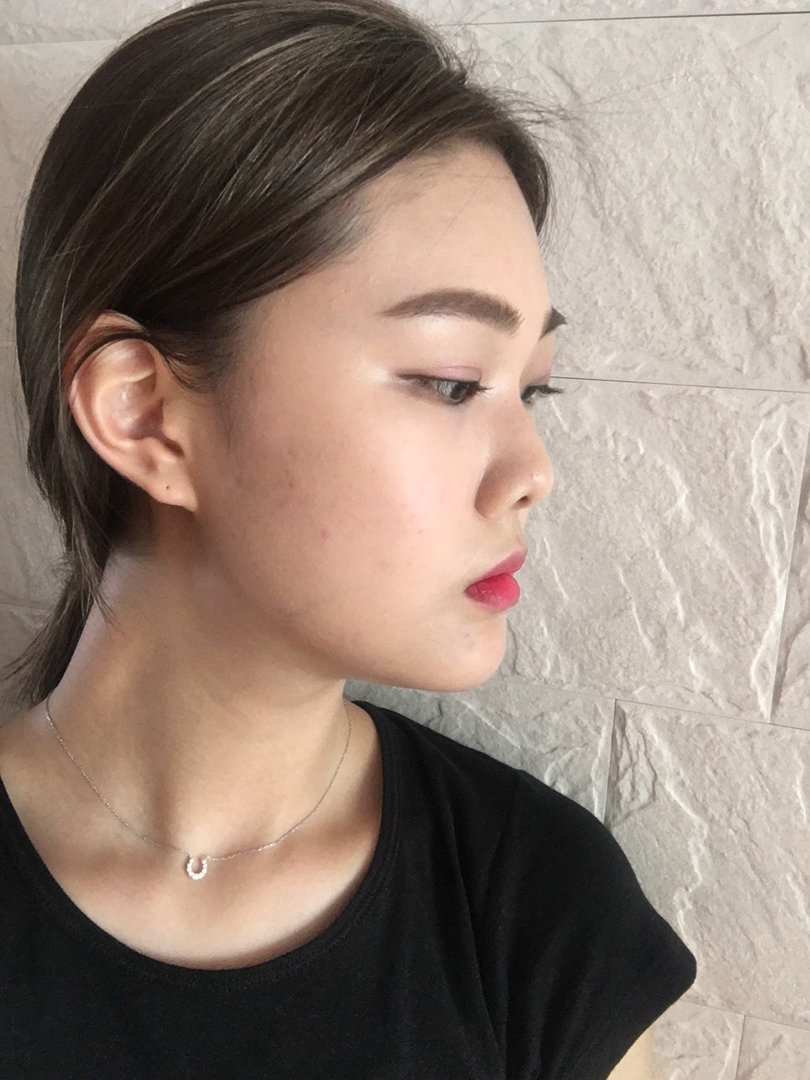 隆鼻前后对比效果图？