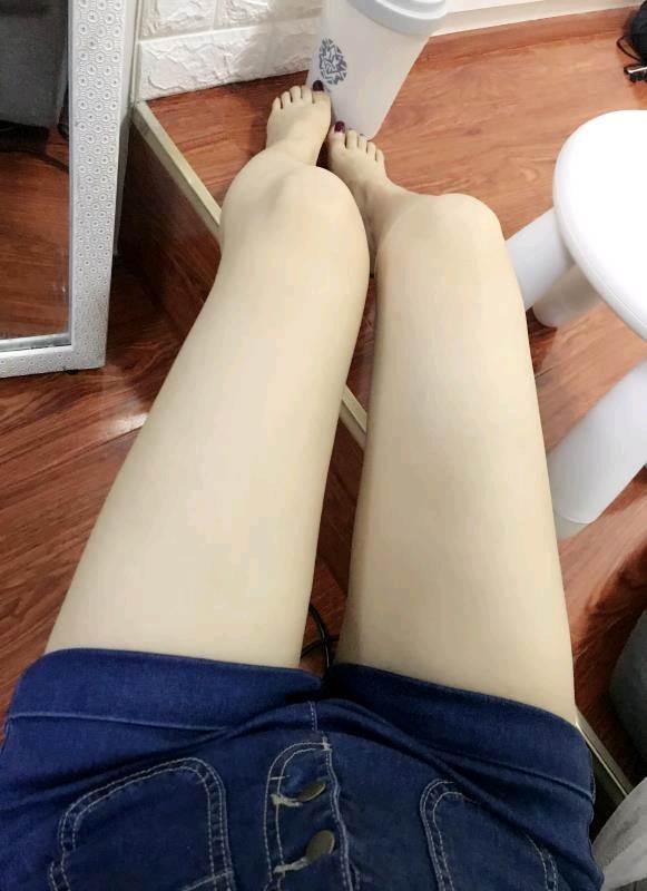 吸脂会反弹吗?