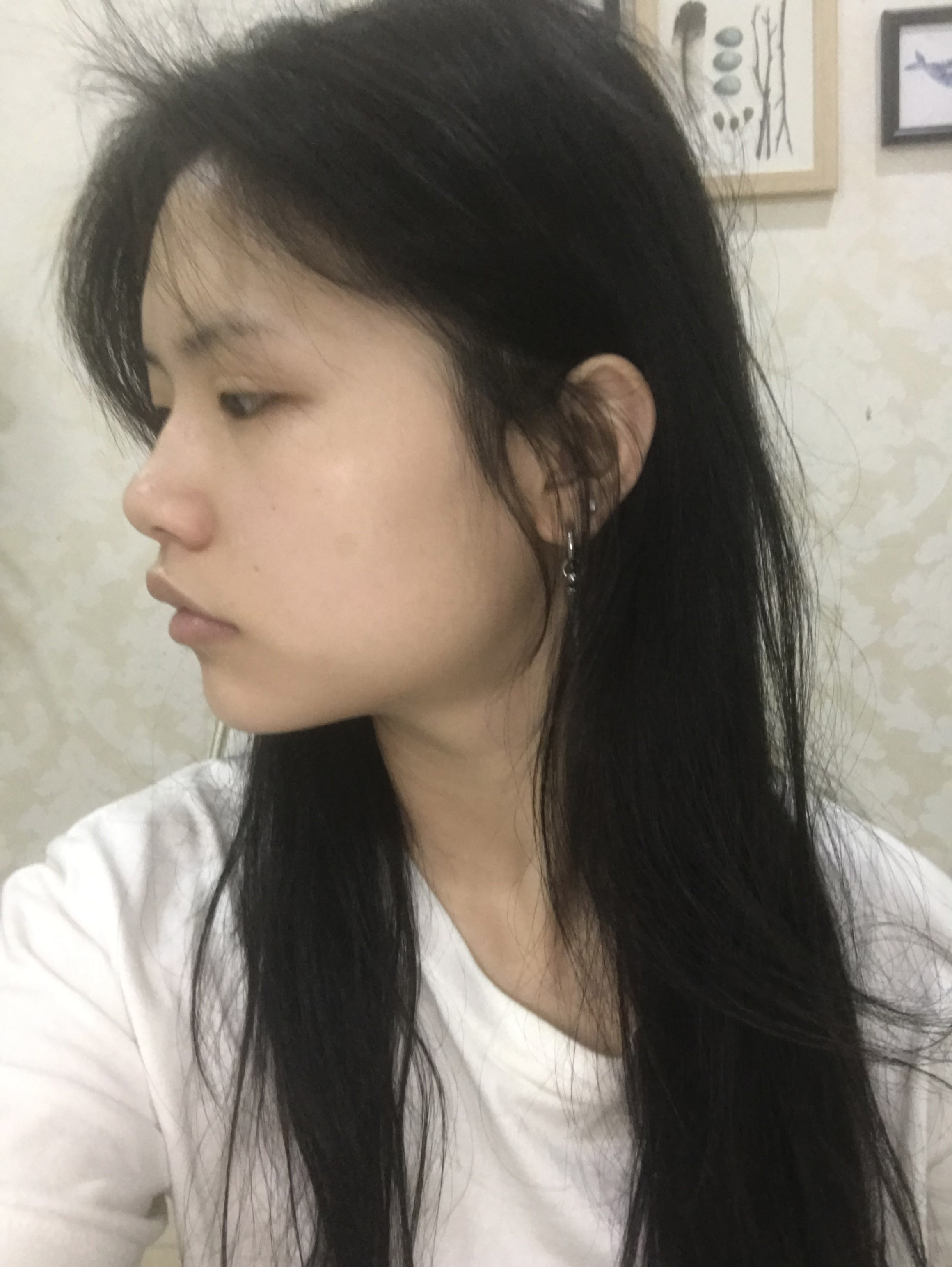 八大处李占强隆鼻怎么样?案例