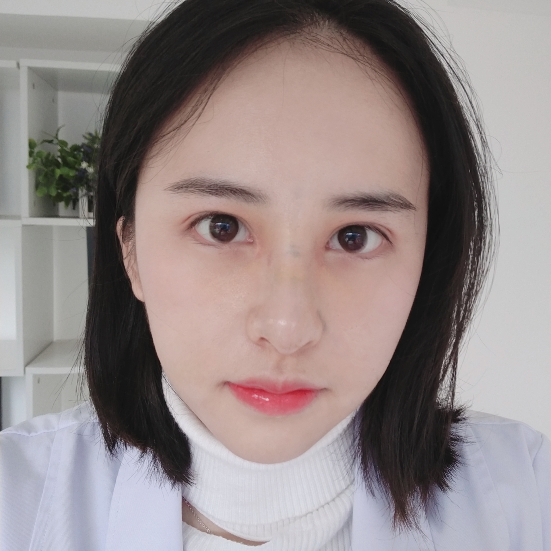 成都娇点隆鼻怎么样?
