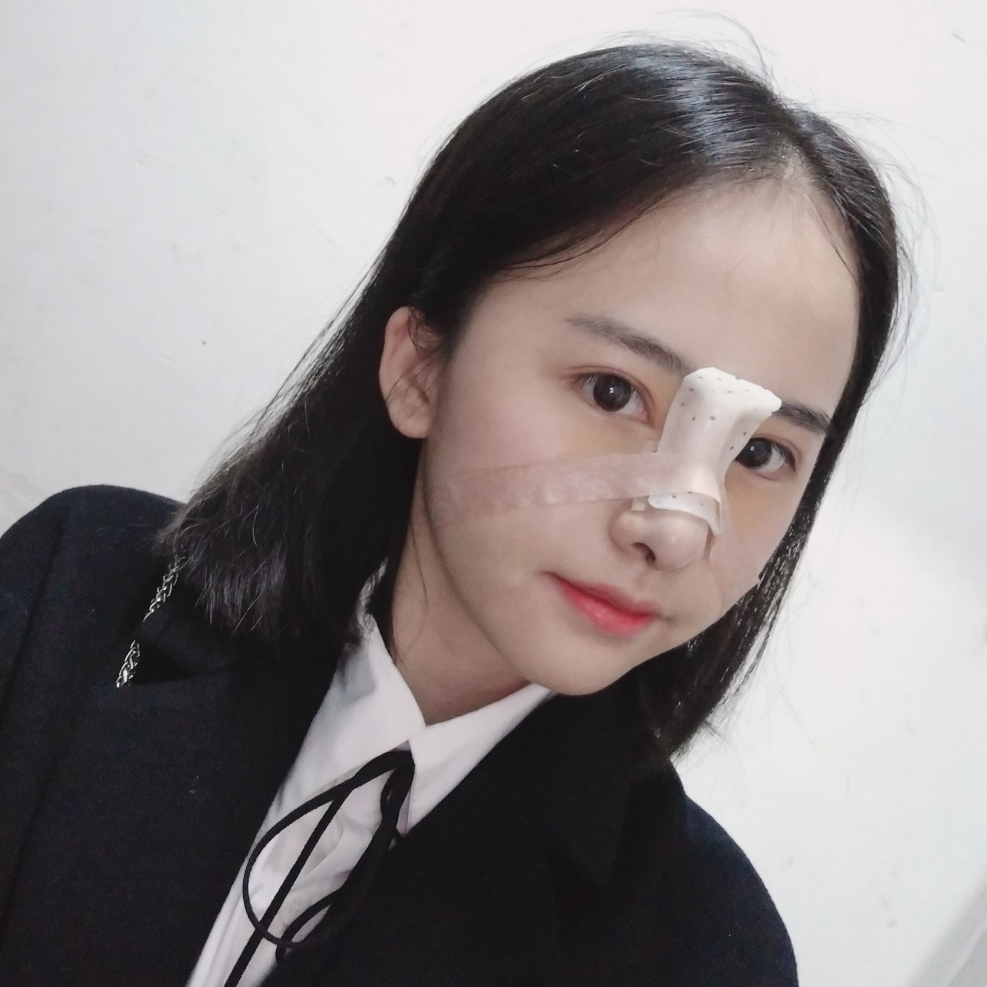 成都娇点隆鼻怎么样?