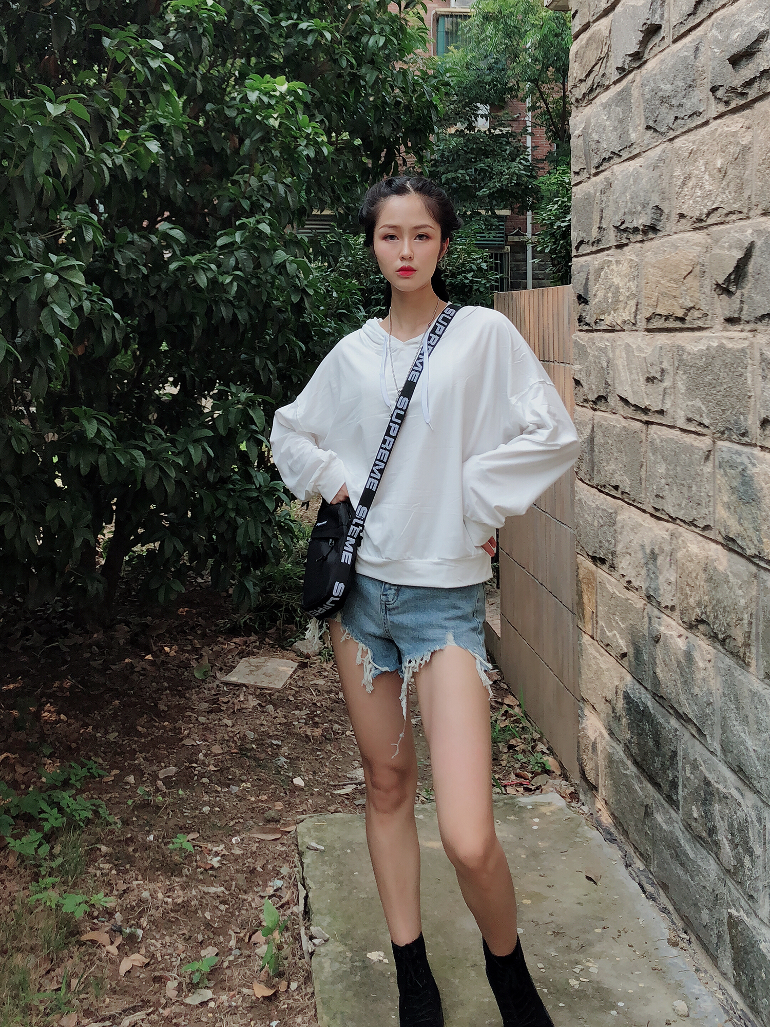 苏州美尔贝大腿吸脂案例？