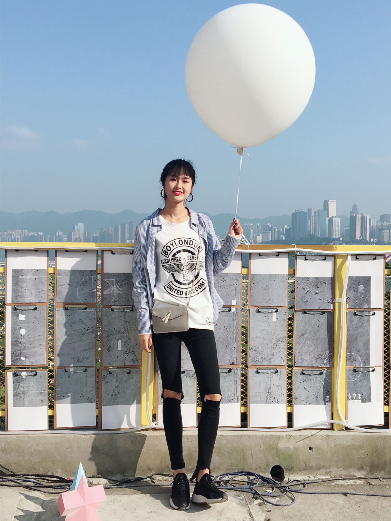 苏州美尔贝大腿吸脂案例