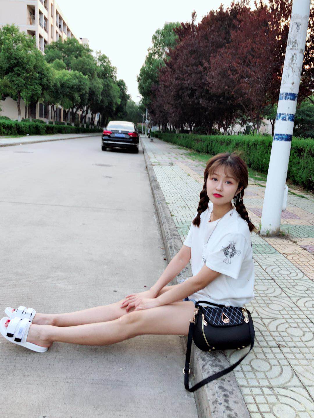苏州美尔贝大腿吸脂案例