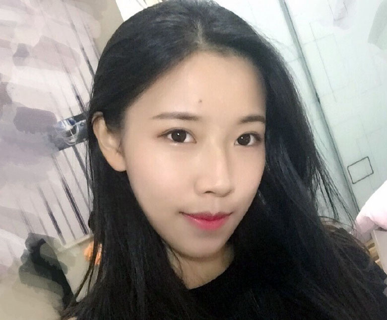 八大处隆鼻谁做的好,附隆鼻案例