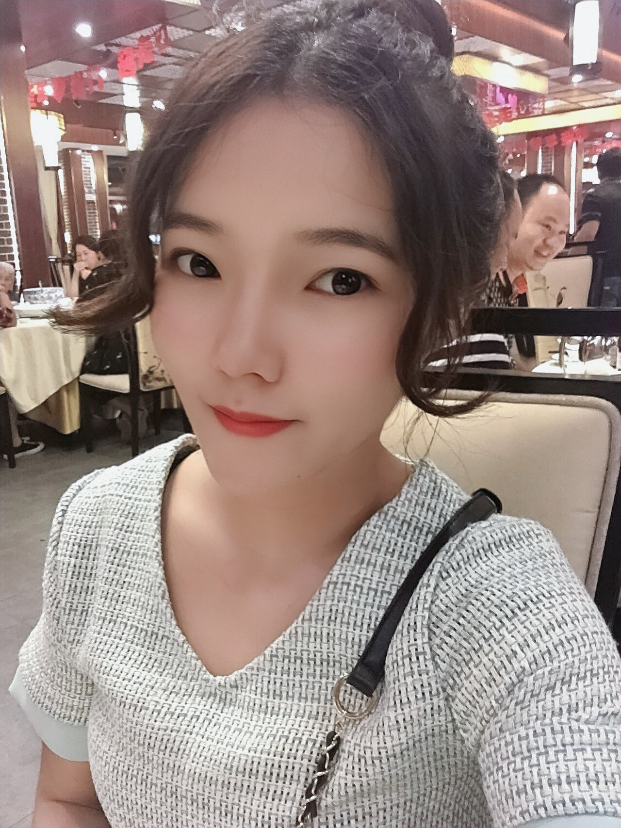 郑州美莱医疗美容医院——鼻修复案例