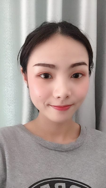 成都八大处于晓波双眼皮案例