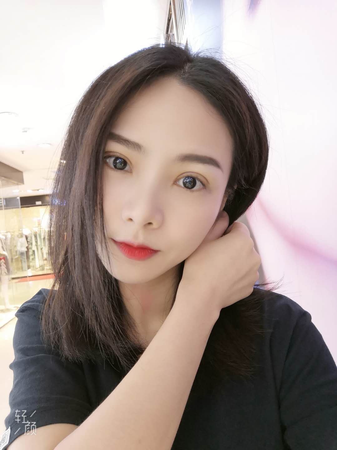 成都八大处于晓波双眼皮案例