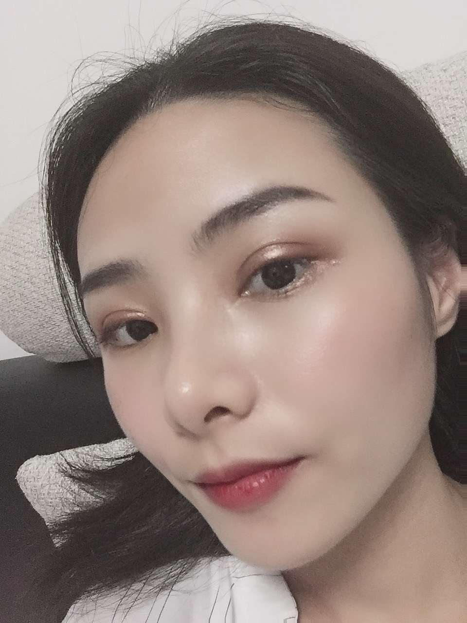 成都八大处于晓波双眼皮案例