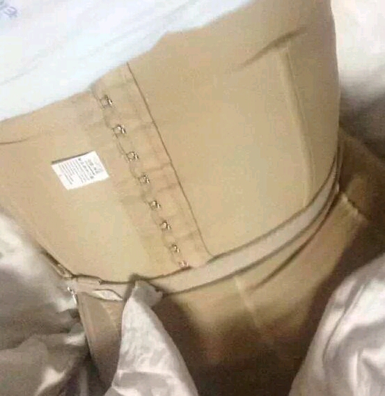 成都八大处唐勇吸脂怎么样？附吸脂案例