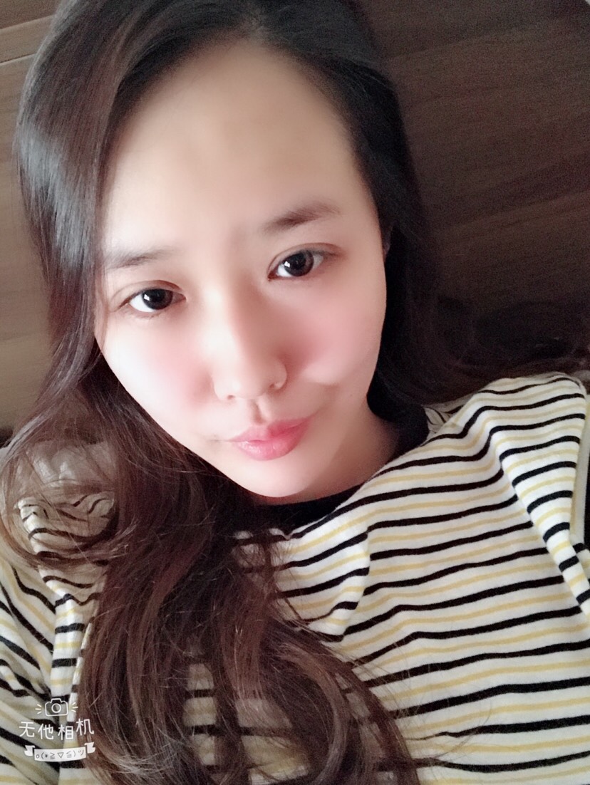 西安西京宋宝强双眼皮案例