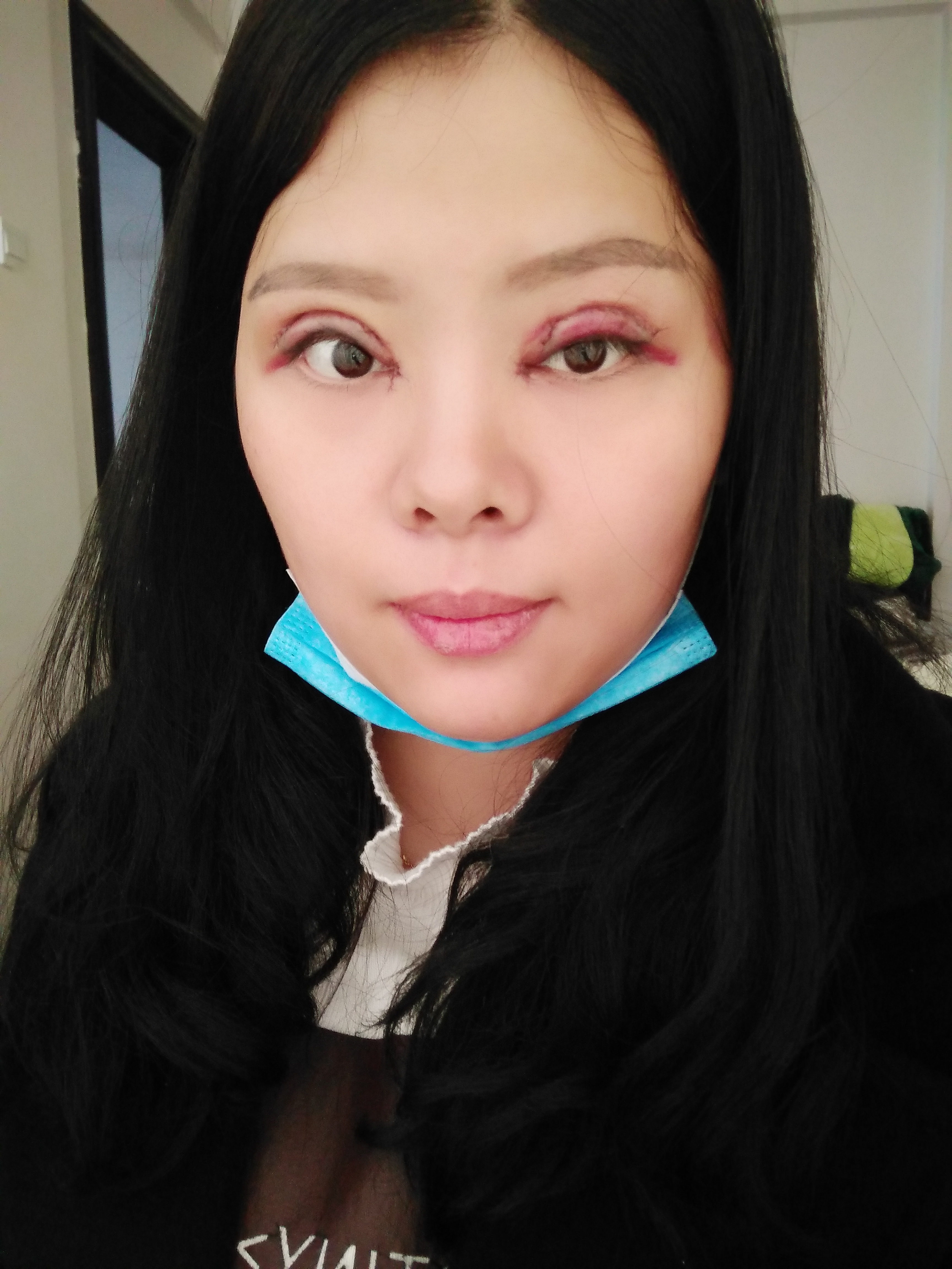 八大处靳小雷做双眼皮修复好不好