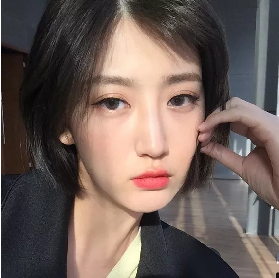 成都米兰柏羽高亮做双眼皮怎么样？附案例