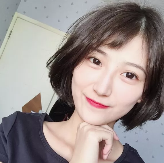 成都米兰柏羽高亮做双眼皮怎么样？附案例
