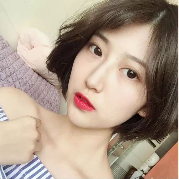 成都米兰柏羽高亮做双眼皮怎么样？附案例