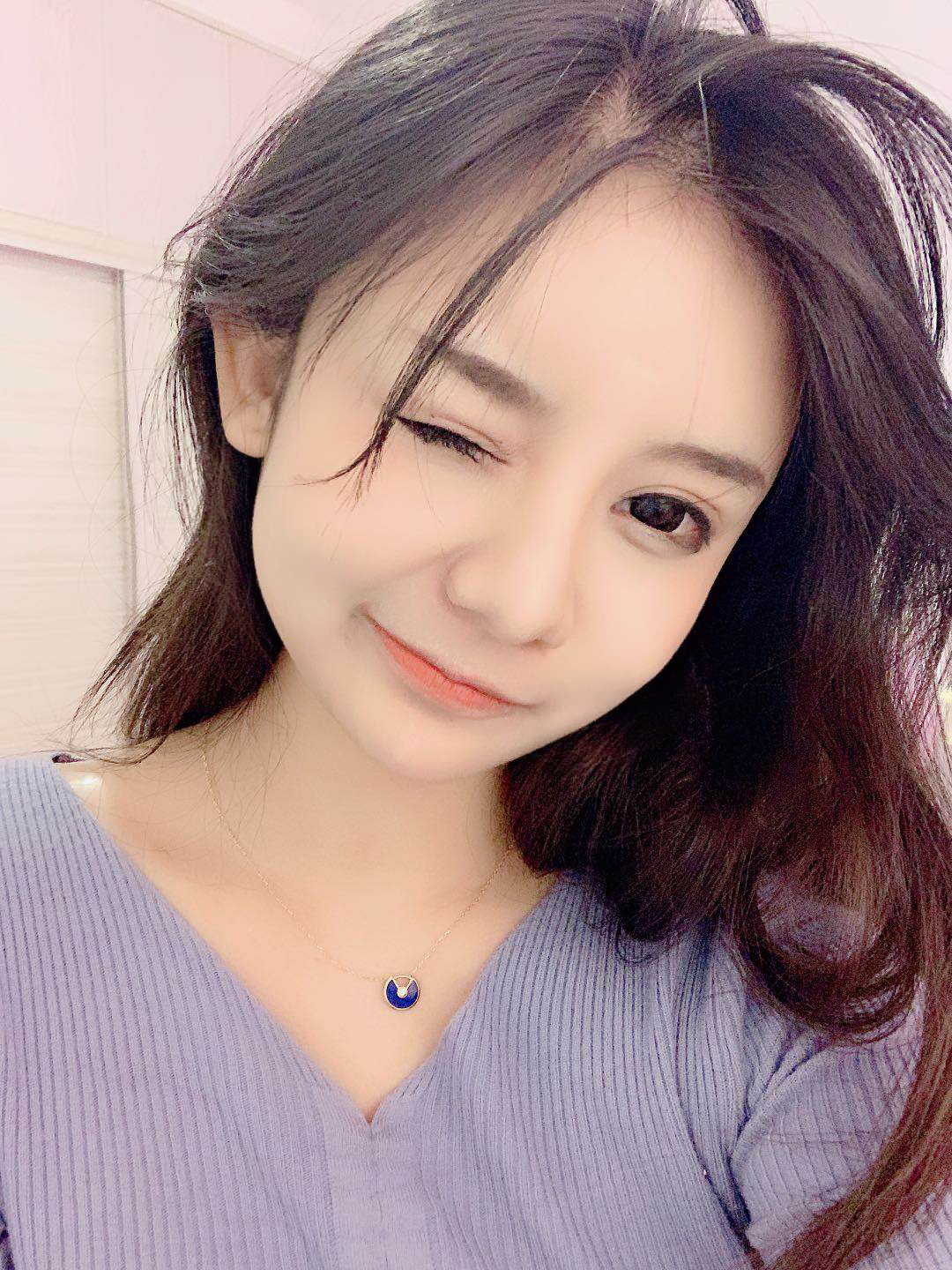 武汉华美整形外科总院怎么样？附V-LINE瓜子脸手术案例
