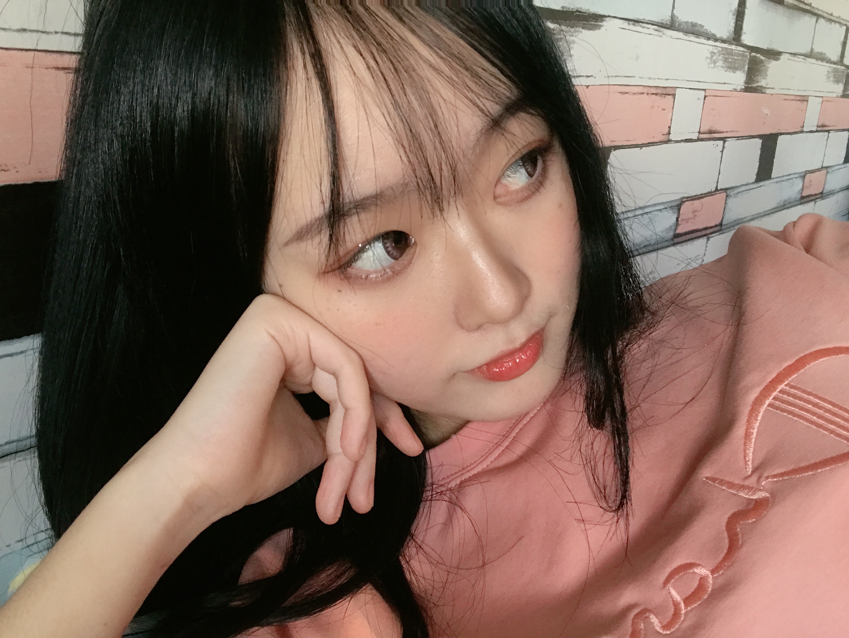 北京米扬丽格巫文云隆鼻案例真人分享