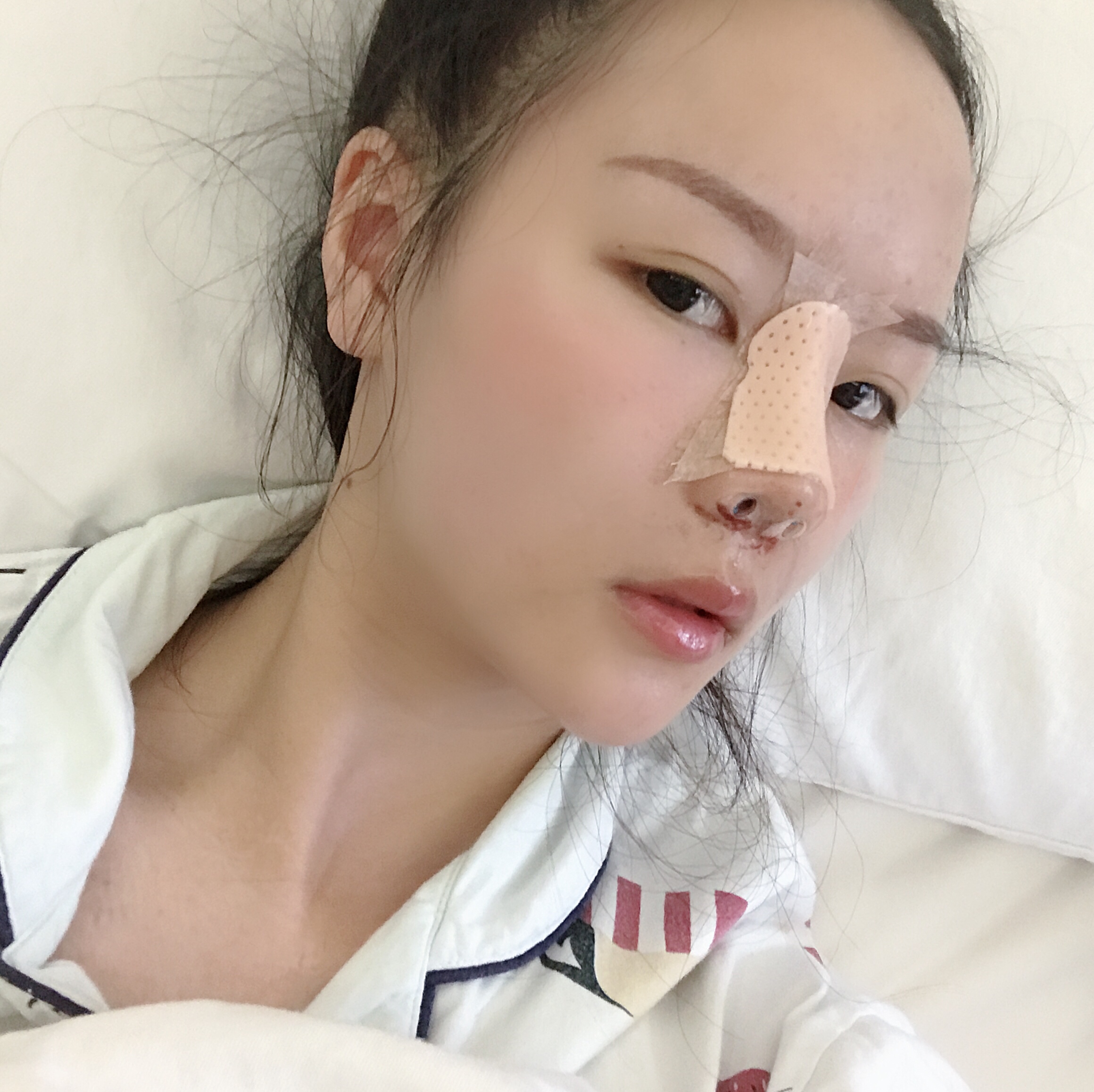 广州曙光整形美容价格表，附鼻部案例