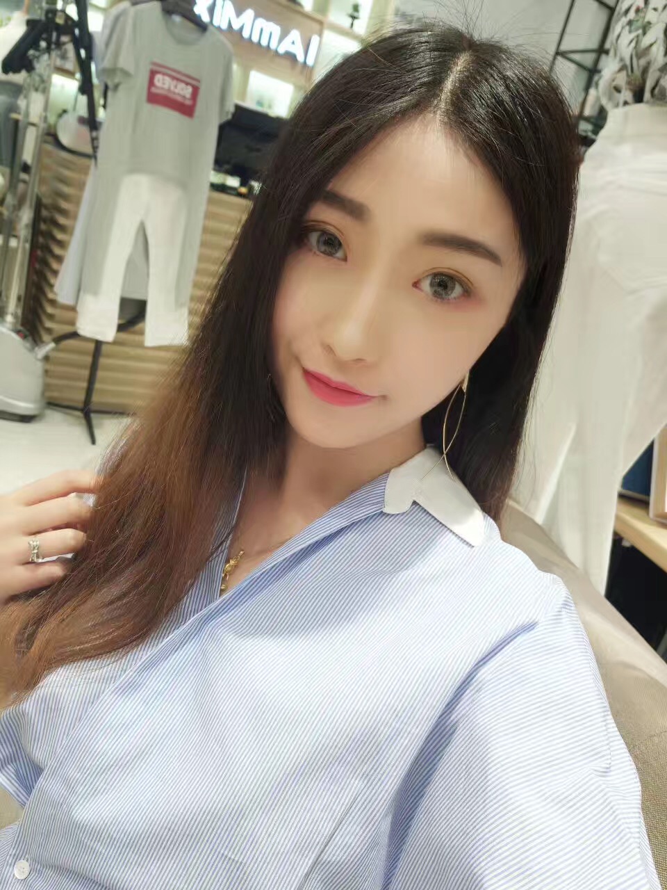 武汉五洲莱美整形医院价格表，附双眼皮案例