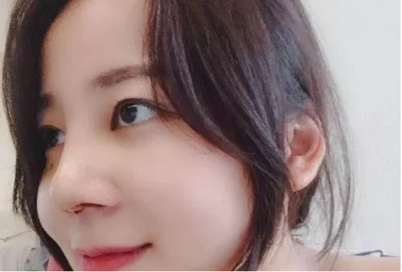 武汉五洲莱美整形美容医院医生刘骏怎么样?附价格表及鼻修复案例 