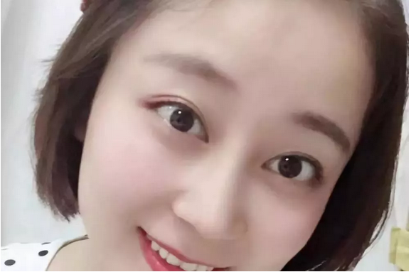 武汉五洲莱美整形美容医院医生刘骏怎么样?附价格表及鼻修复案例 