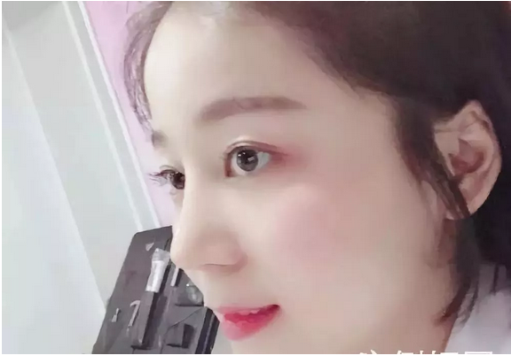 武汉五洲莱美整形美容医院医生刘骏怎么样?附价格表及鼻修复案例